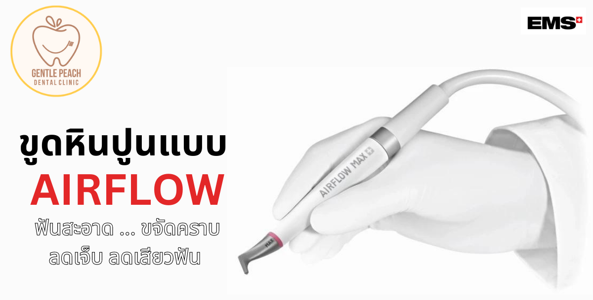 ขูดหินปูน airflow ems เจนเทิลพีช gentle peach ทำฟัน นครอินทร์ พระราม5 ราชพฤกษ์