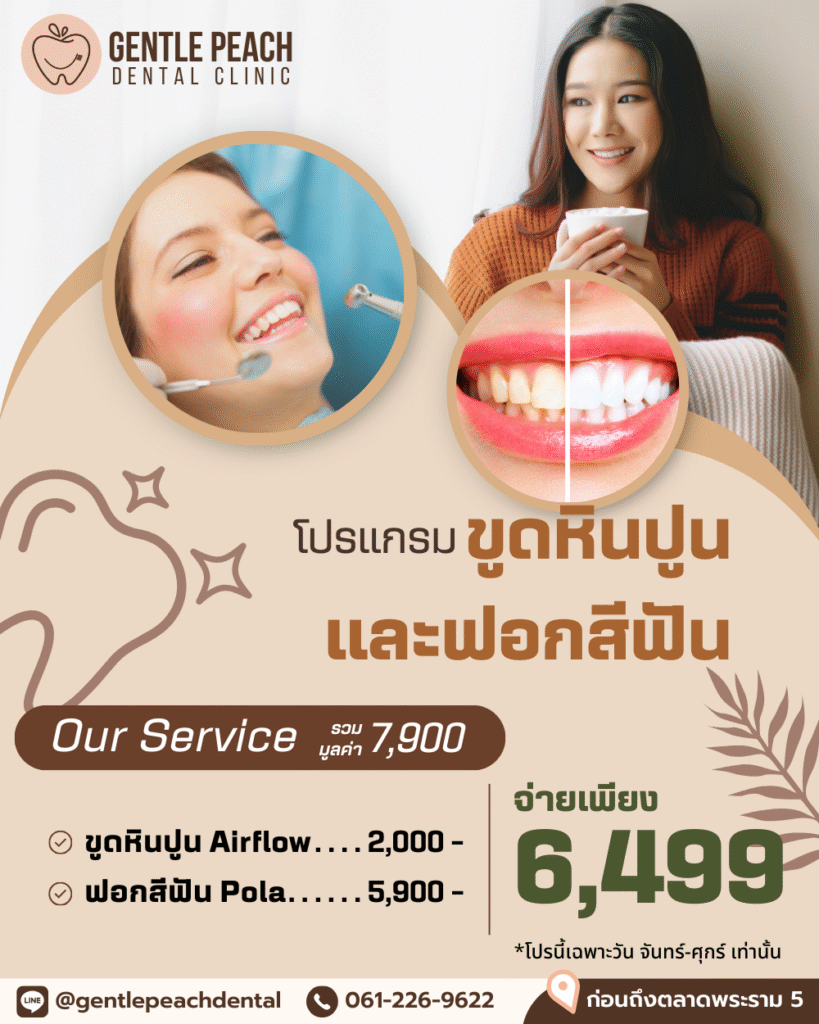 สปาฟัน ขูดหินปูน ฟอกสีฟัน