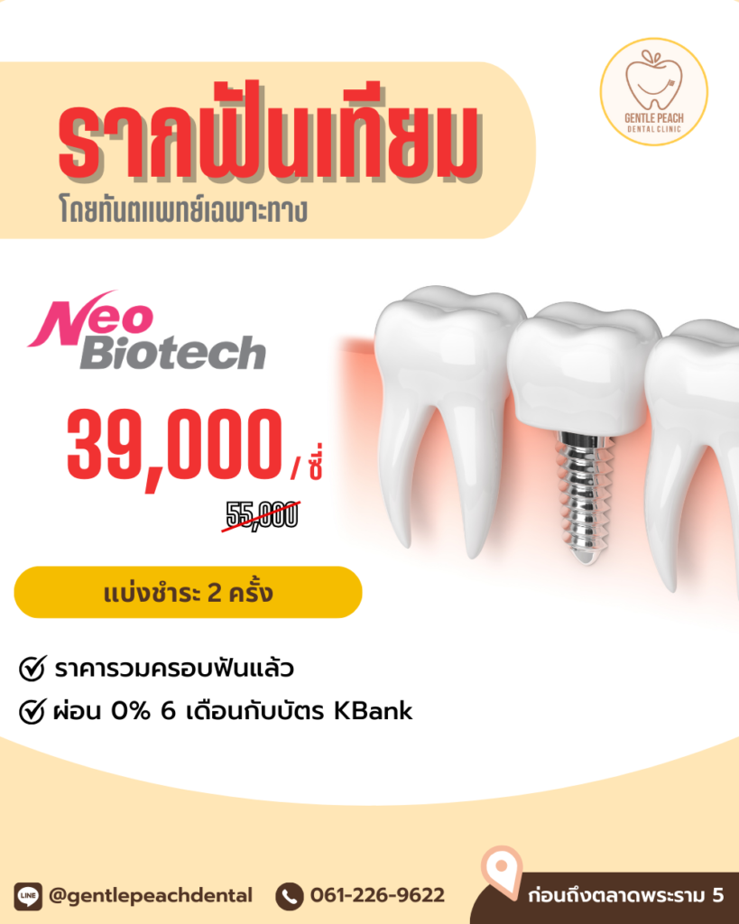 โปรโมชั่น รากเทียม รากฟันเทียม neobiotech