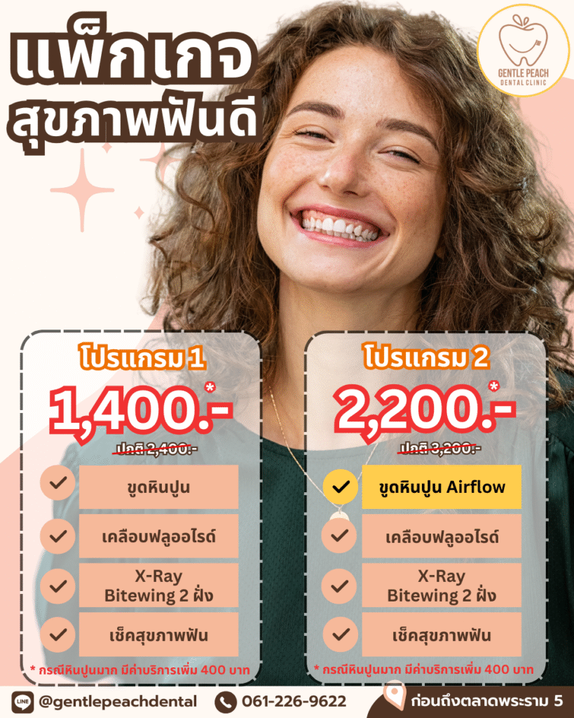 ขูดหินปูน นนทบุรี ขูดหินปูน ราชพฤกษ์ ตรวจสุขภาพฟันประจำปี ตรวจฟัน ตรวจสุขภาพฟัน