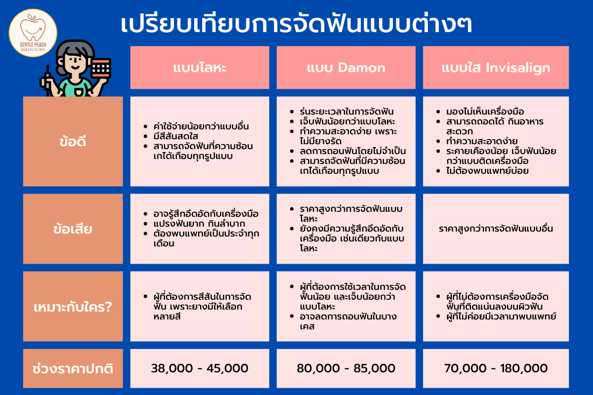 เปรียบเทียบการจัดฟันแบบต่างๆ จัดฟันแบบไหนดี จัดฟันมีกี่แบบ เจนเทิลพีช จัดฟัน จัดฟันใส damon ข้อดี ข้อเสีย จัดฟันราขพฤกษ์