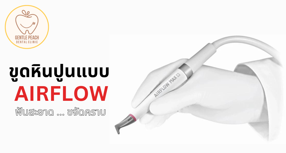 ขูดหินปูน airflow ems