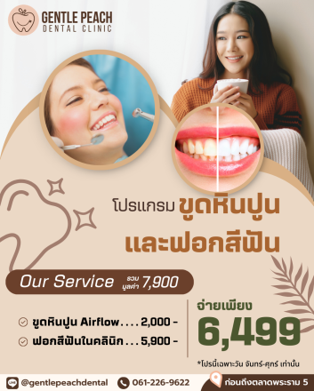 ขูดหินปูน ฟอกสีฟัน