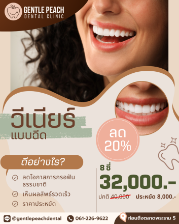 วีเนียร์แบบฉีด