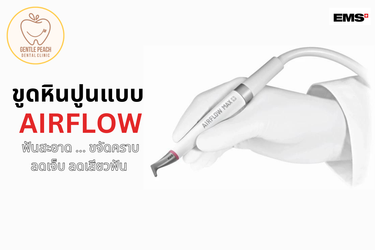 ขูดหินปูน EMS Airflow Gentle Peach Dental Clinic