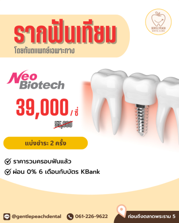 โปรโมชั่น รากเทียม รากฟันเทียม neobiotech